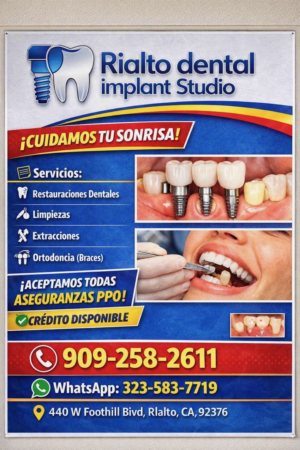 Atención Dental-Rialto Dental Implant Studio