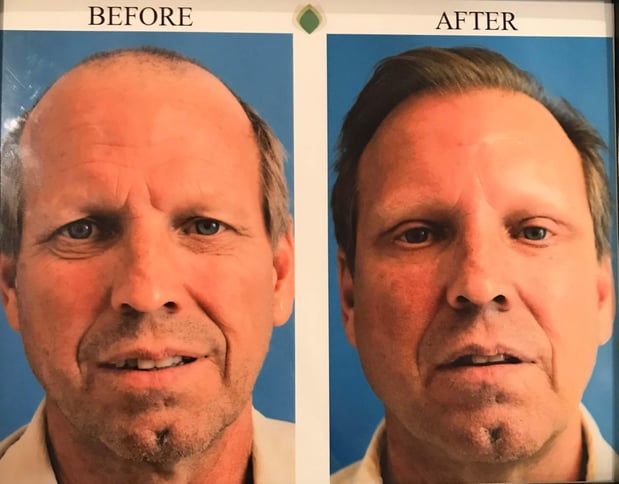 Images Dr. George Brennan - Cosmetic Surgeon Newport Beach