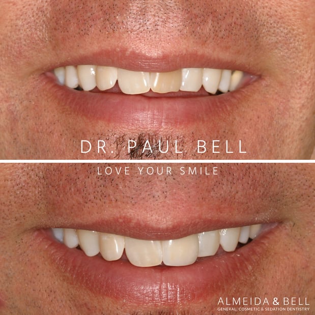 Images Almeida & Bell Dental Lone Tree - General, Cosmetic, and Implant Dentistry