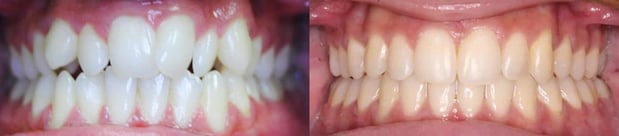 Images TLC Pediatric Dentistry and Orthodontics