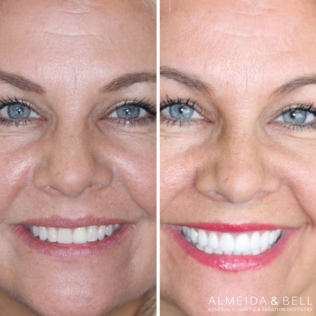 Images Almeida & Bell Dental Lone Tree - General, Cosmetic, and Implant Dentistry