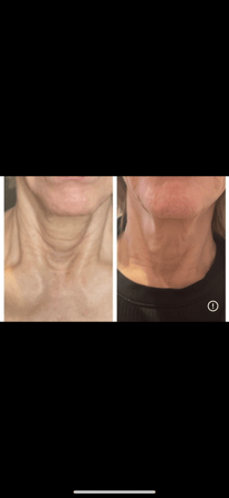 Images Body Lounge Park Cities - Whole Body Wellness & Medical Aesthetics, Dallas, TX