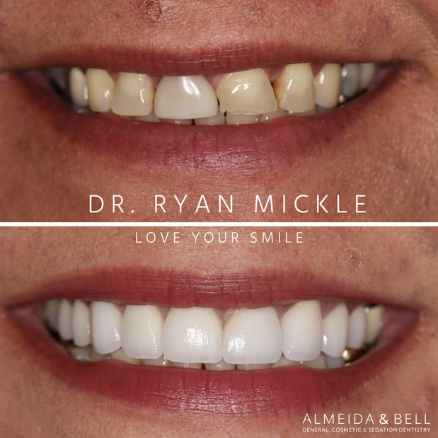 Images Almeida & Bell Dental Lone Tree - General, Cosmetic, and Implant Dentistry