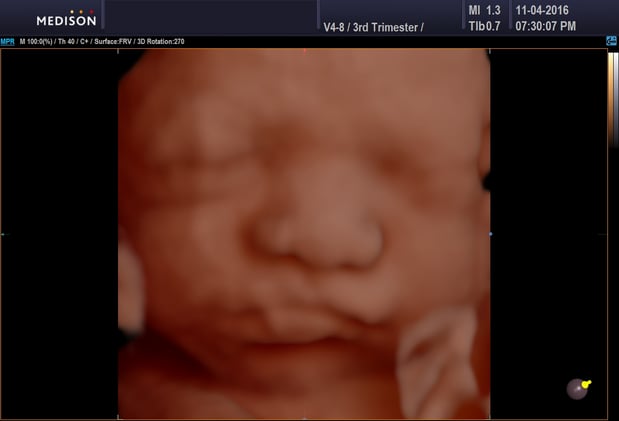 Images Heavenly 3D 4D Ultrasounds