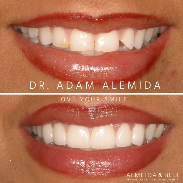 Images Almeida & Bell Dental Lone Tree - General, Cosmetic, and Implant Dentistry