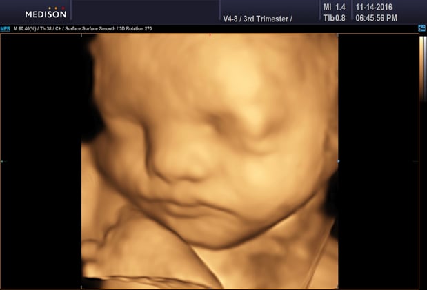 Images Heavenly 3D 4D Ultrasounds