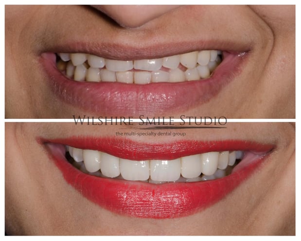Images Wilshire Smile Studio - Los Angeles Dentist, Cosmetic and Emergency Dentistry