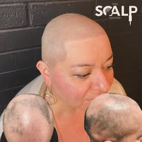 Images The Scalp Master