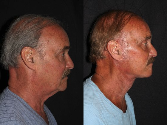 Images Lee Facial Plastic Surgery