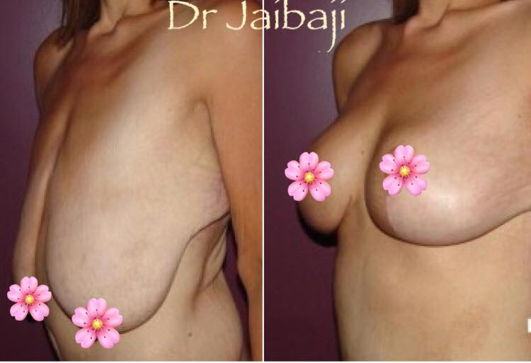 Jaibaji Plastic Surgery Photo