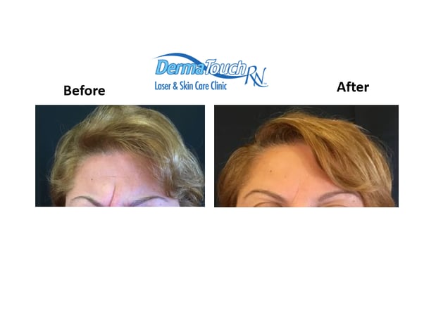 Images DermaTouch RN