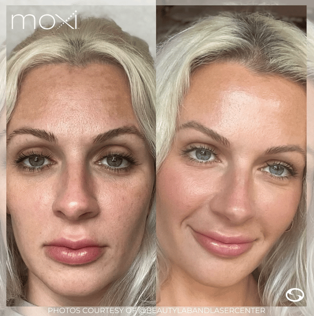 Images Serenity Aesthetics & Wellness