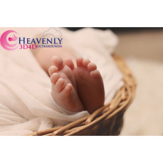 Images Heavenly 3D 4D Ultrasounds