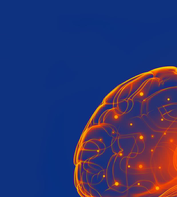 Images Kings View Clovis DUI