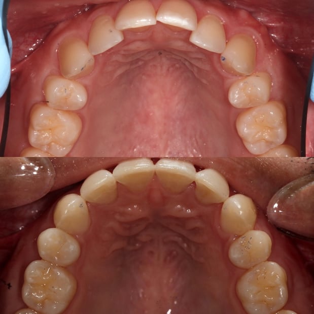 Images Avenue Dental