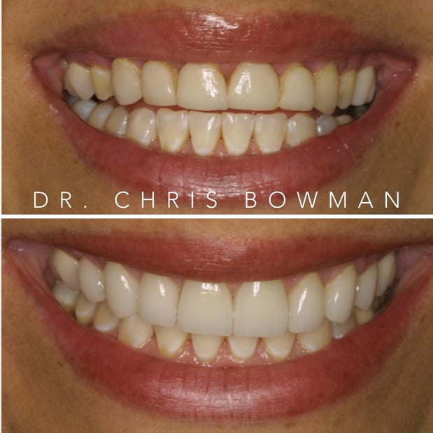 Images Advanced Dentistry of Charlotte