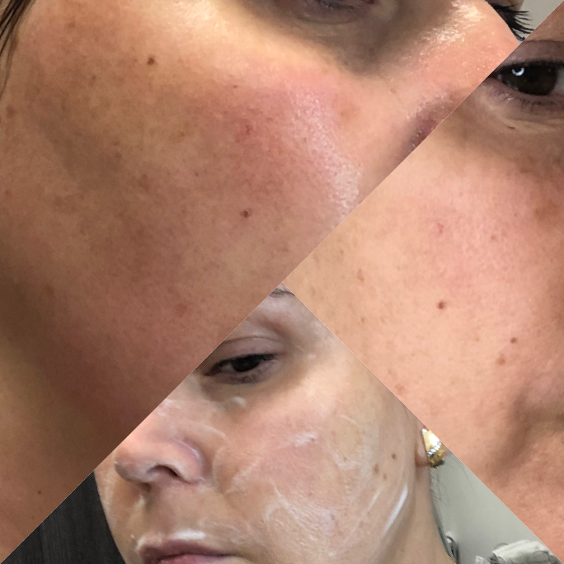 Images Clinique d'Esthétique Leila - Hydrafacial, Microblading, Épilation Laser Sainte-Foy