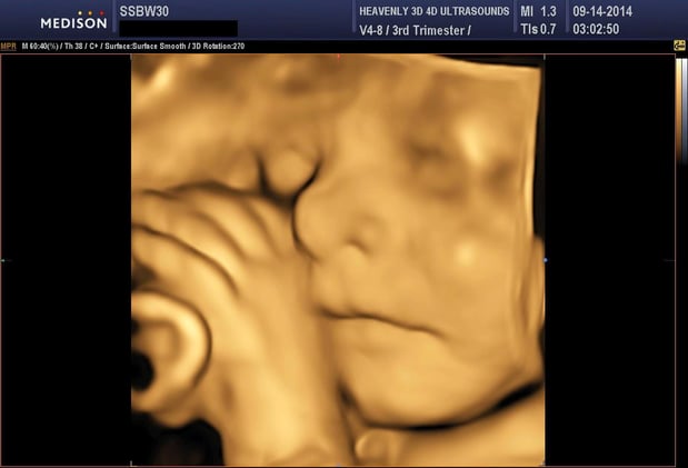 Images Heavenly 3D 4D Ultrasounds-Upland