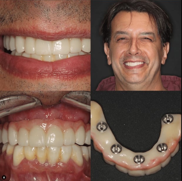 Images Queensboro Oral Surgery & Associates