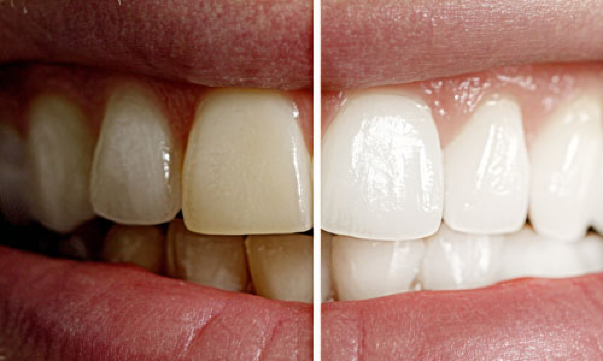 Pico Rivera Family Dentistry Image