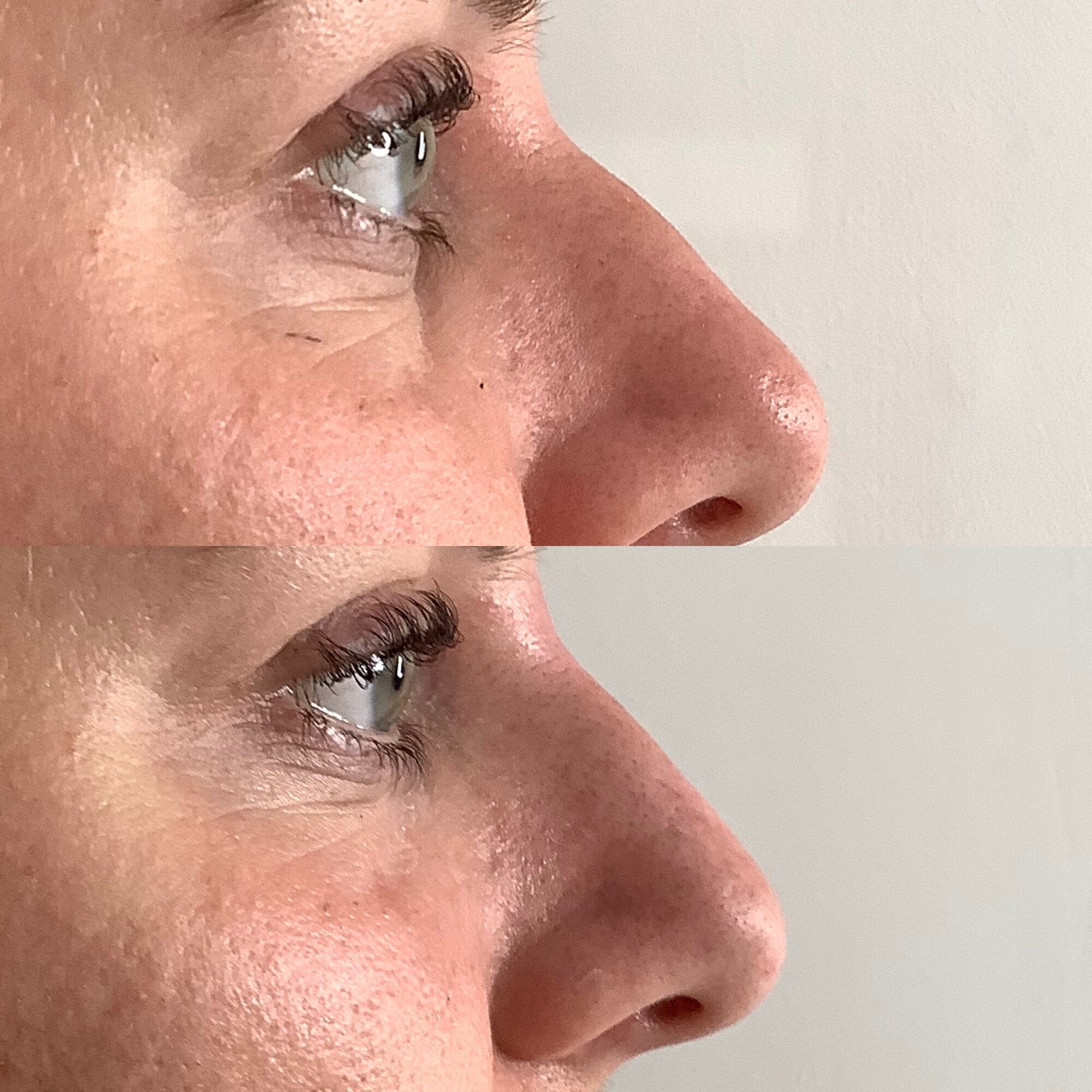 Images Harvey Medical Aesthetics