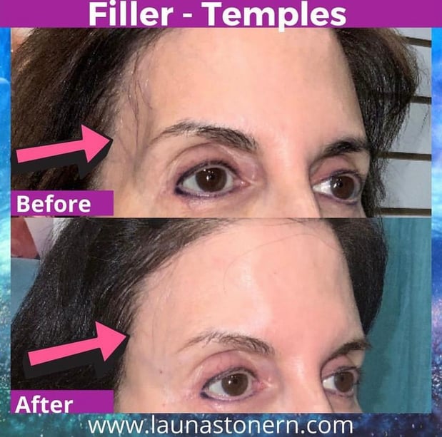 Images Launa Stone, R.N.