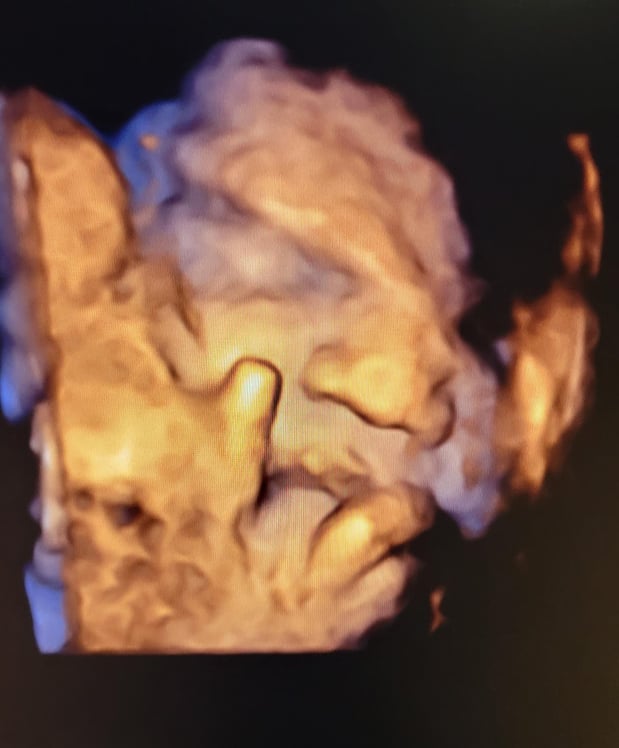 Images Love At First Sight 3D/4D Ultrasound Imaging Studio, LLC