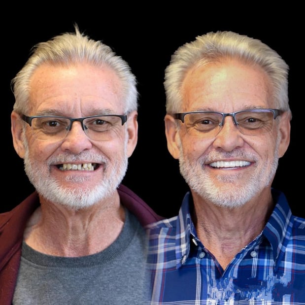 Images Smile Now Milwaukee Dentures and Implants