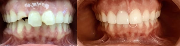 Images Premier Dental of South Orange County