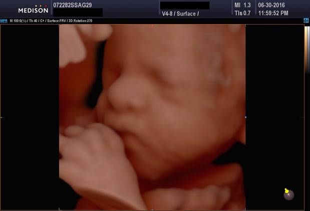 Images Heavenly 3D 4D Ultrasounds