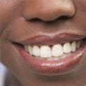 Maryland Periodontics and Dental Implants Photo