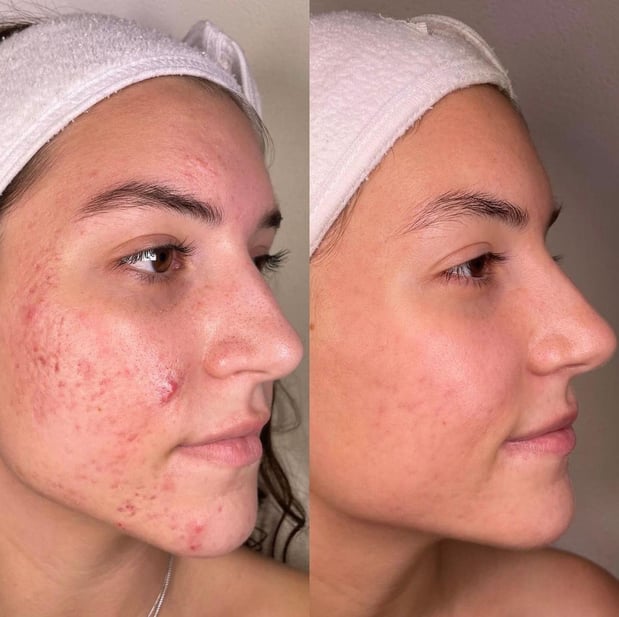 Images Face of Jules