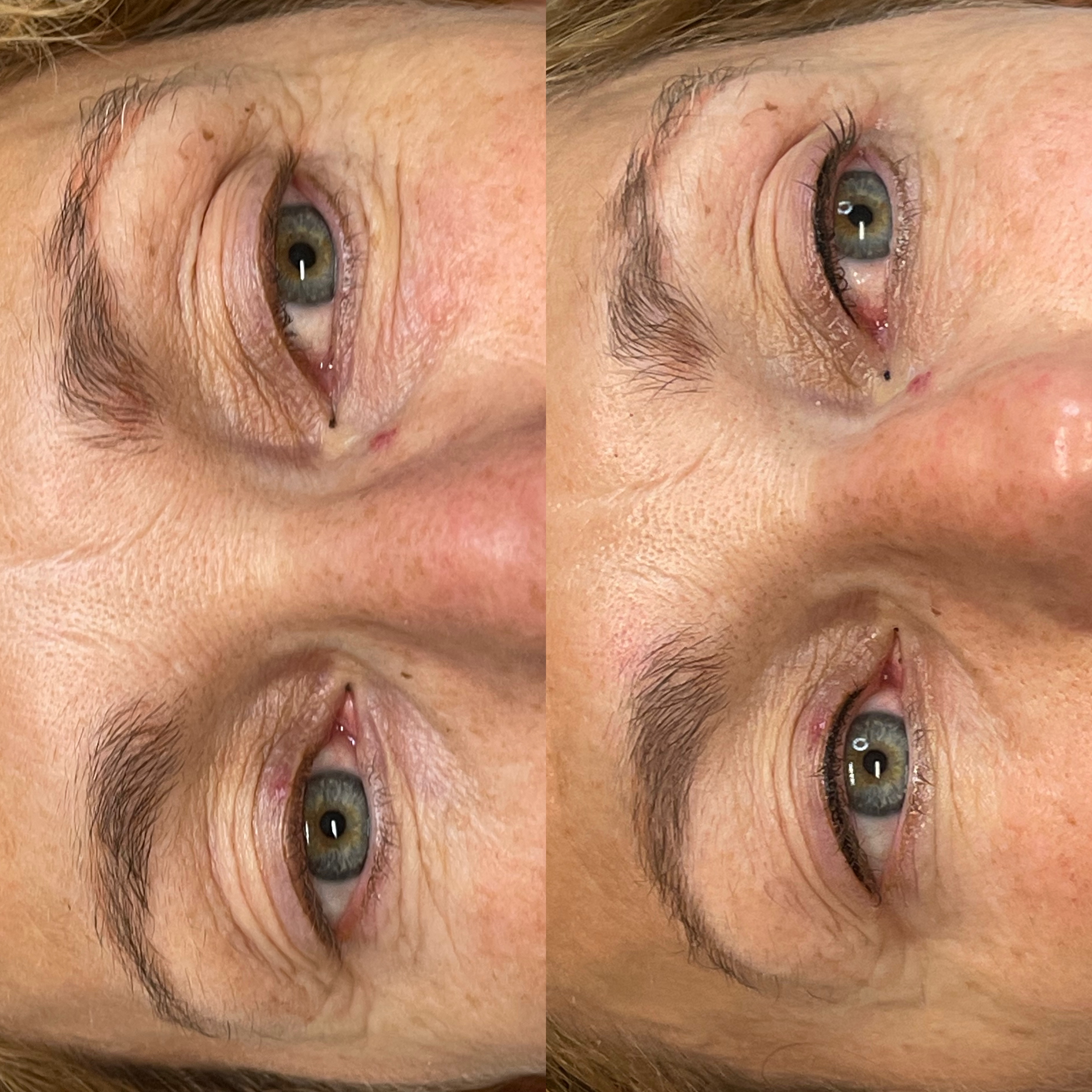 Images Clinique d'Esthétique Leila - Hydrafacial, Microblading, Épilation Laser Sainte-Foy