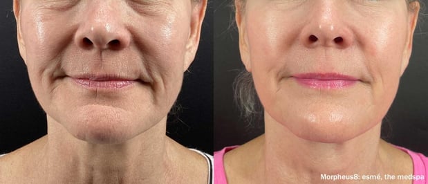 Images EliteBio: Hormone and Aesthetic Solutions