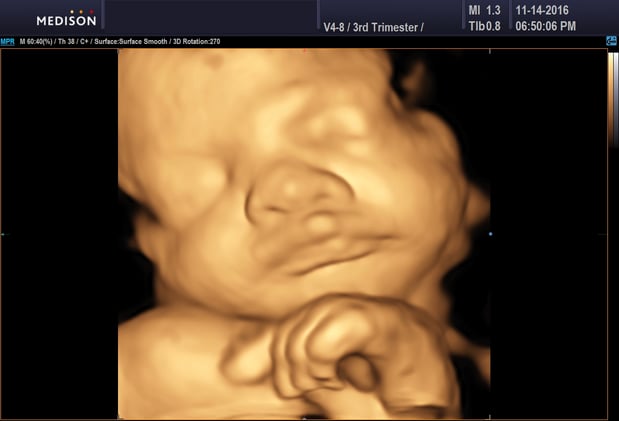 Images Heavenly 3D 4D Ultrasounds