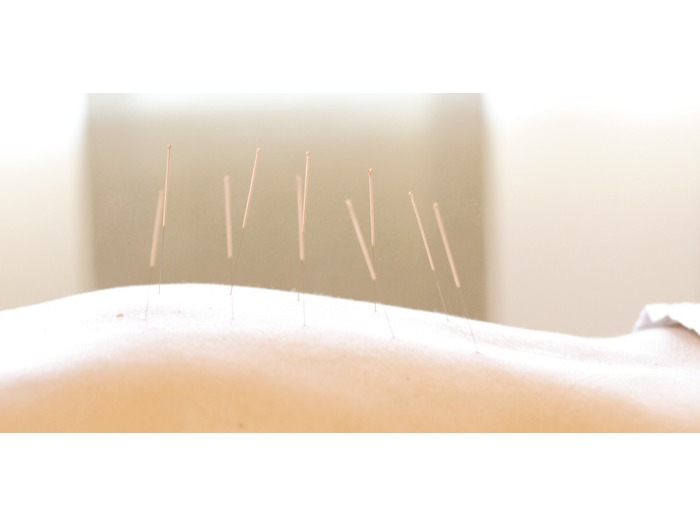 Qimedic - Traditionelle Chinesische Medizin, Paulistraße 3 in Frechen