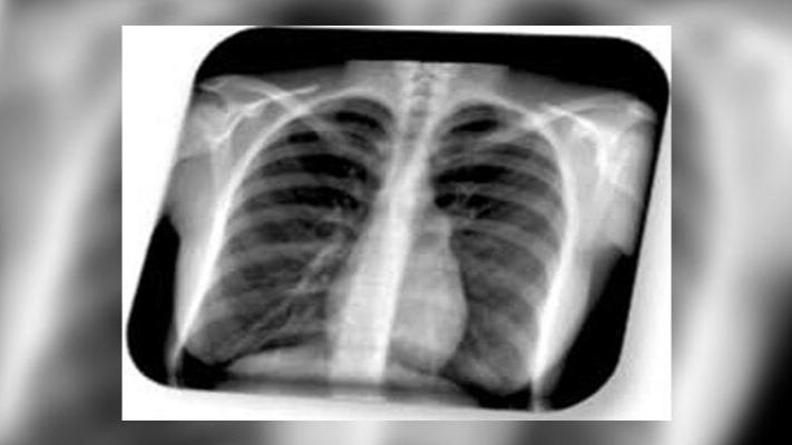 Images Radiología Del Sureste