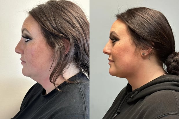Images Providence Facial Plastic and Cosmetic Surgery