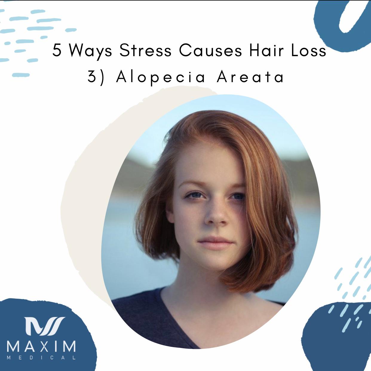 3. Alopecia Areata

Alopecia Areata is one of many types of hair loss. Alopecia itself is characterized by your body’s own immune system attacking your hair follicles thus causing hair loss. In normal circumstances, your immune system acts as a defense from foriegn bacteria and viruses. In the case of Alopecia Areata, your immune system views hair follicles as foreign thus they attack them. This specific type of hair loss is also characterized by hair loss in small round patches. This can occur in both men and women equally, though it is not very well understood why it happens.