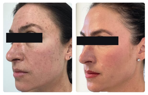 Images Glösense Dermatology & Aesthetic