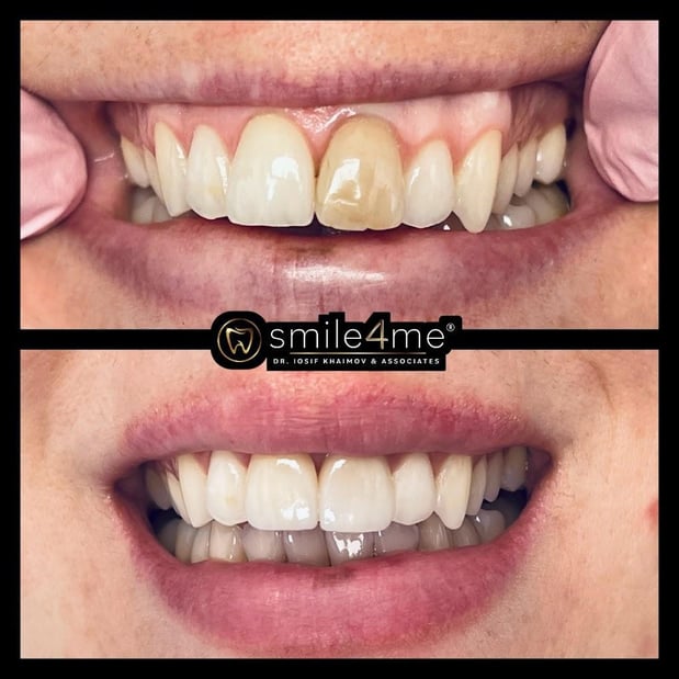 Images smile4me Dental Care - Astoria, Queens