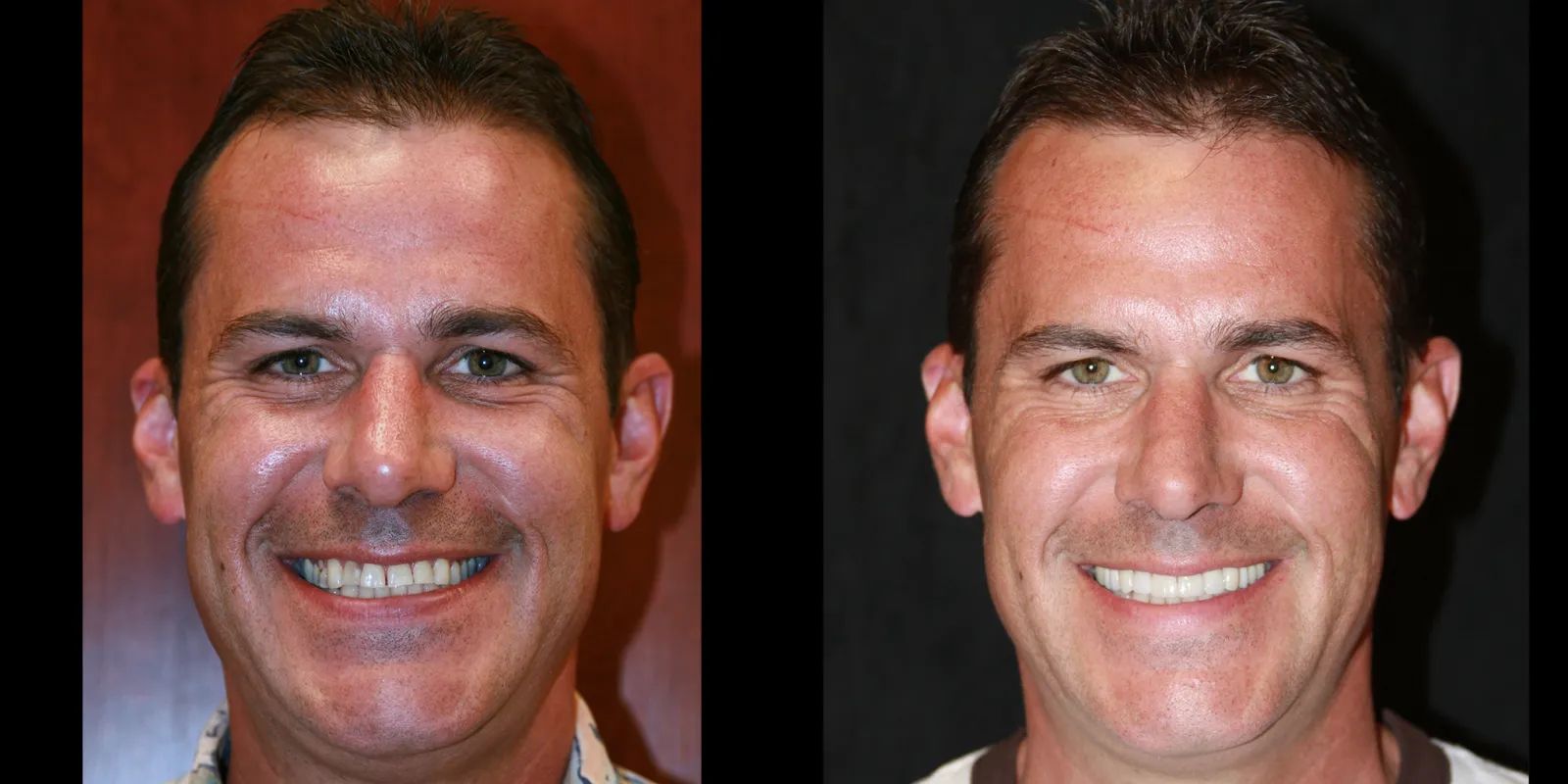 Intermountain Smiles Image