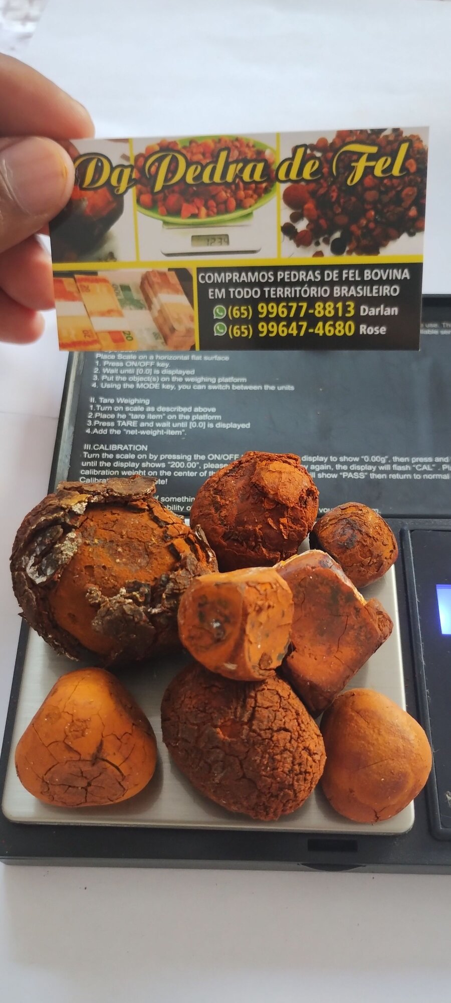 Images Dg pedras de fel bovinos