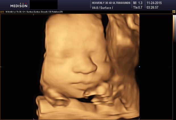 Images Heavenly 3D 4D Ultrasounds-Upland