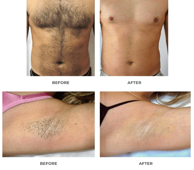 Images Permanent Makeup & Aesthetics in Maine