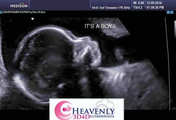 Images Heavenly 3D 4D Ultrasounds-Upland