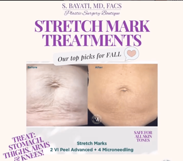 Images Semira Bayati, MD, FACS