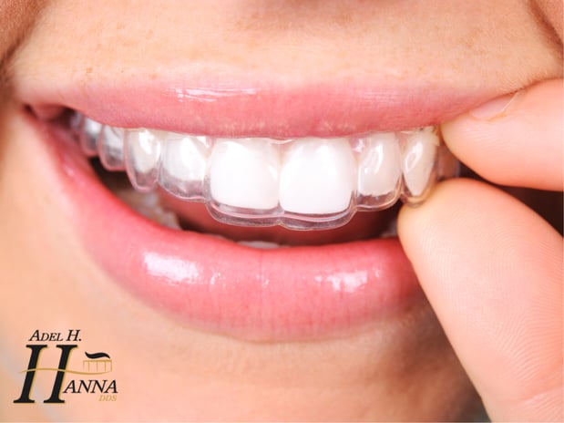 Images Adel H Hanna, DDS & Assoc.