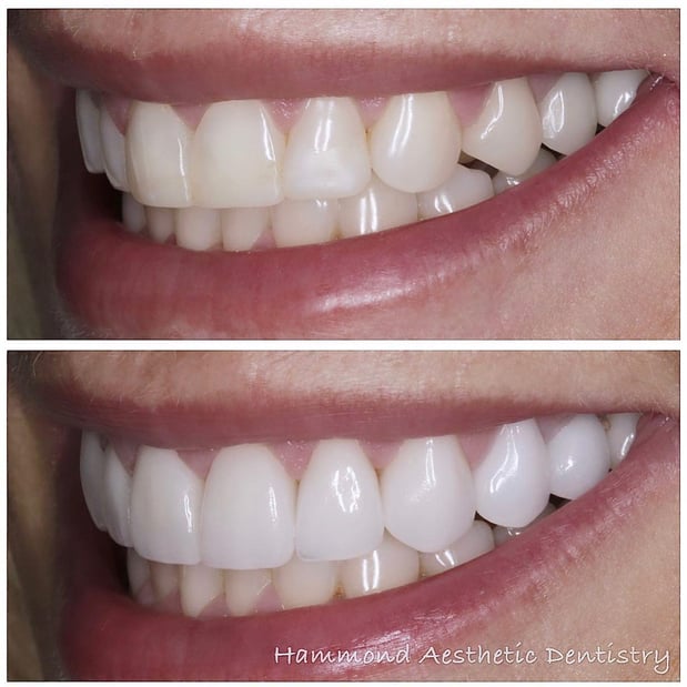 Images Hammond Aesthetic & General Dentistry