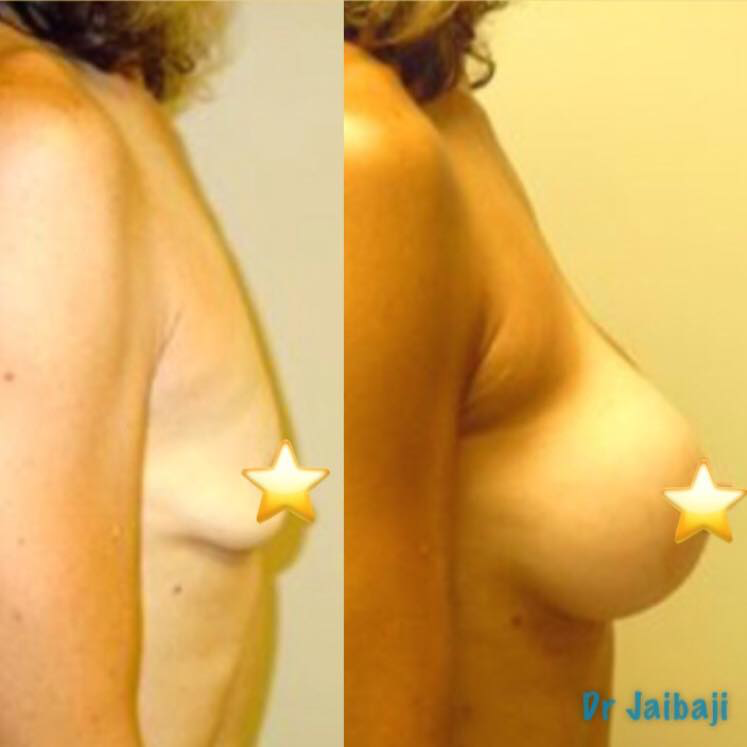 Jaibaji Plastic Surgery Photo